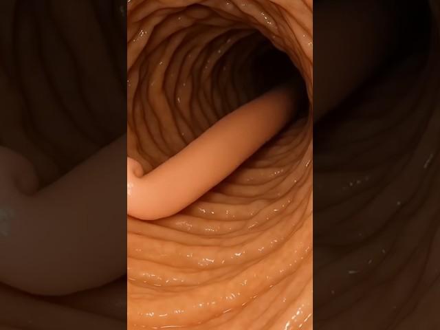 How The Gut look like Without Deworming | Realistic AI Art | Gut Health | Anatomy AI Arts USA | 27