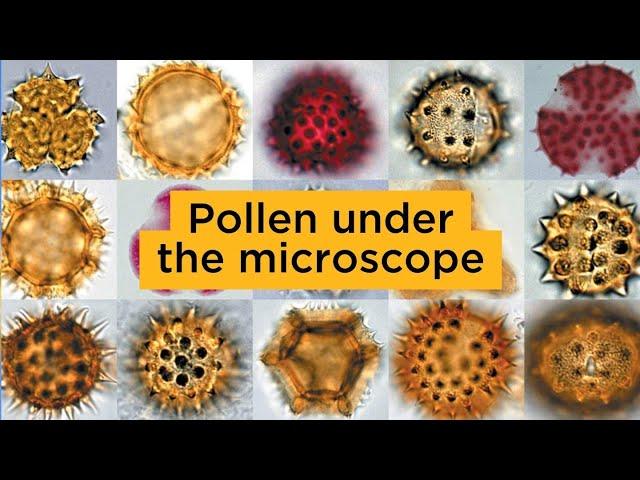 Pollen under the microscope