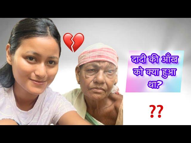 दादी की आँख को क्या हुआ था?// Accident Story// @KarinaDowarah1 #vlog