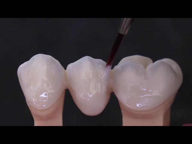 TECNICA 4.4.1. di microstratificazione liquida della zirconia KATANA - Video by Odt. D. Rondoni