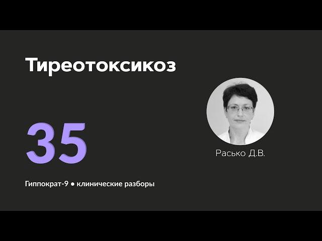 Тиреотоксикоз. 01.11.24.