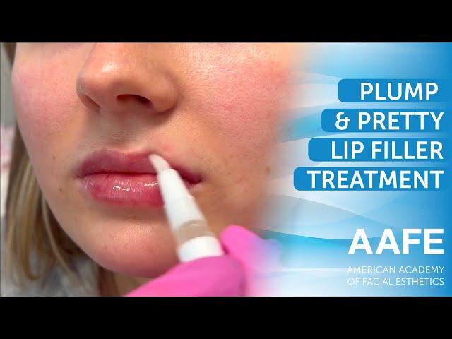 Plump and Pretty Lip Filler Treatment