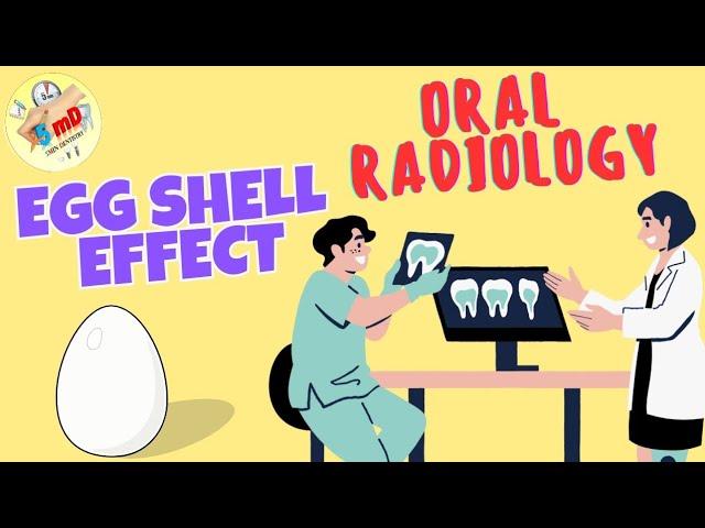 EGG SHELL EFFECT - Oral Radiology - simple explanation - 5 min Dentistry