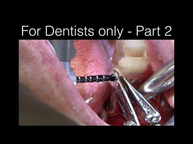 ***For Dentists only part 2 - Surgery with Scott MacLean