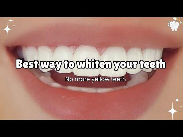 Teeth Whitening at Home in just 2 minutes   #teethwhitening