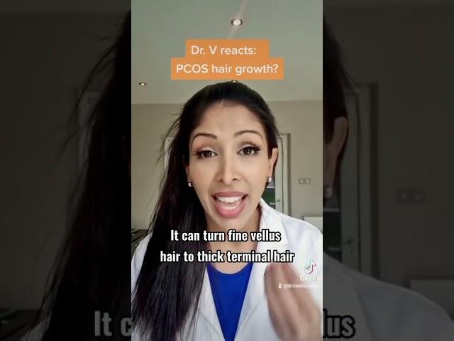 PCOS facial hair is very common. Share with someone who has PCOS. #doctorv