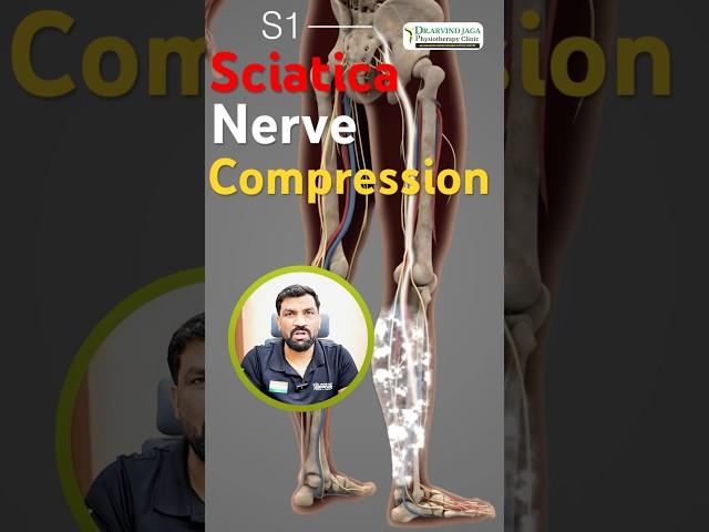 Sciatica Nerve Compression?  by Physiotherapist Dr. Arvind Jaga #sciatica