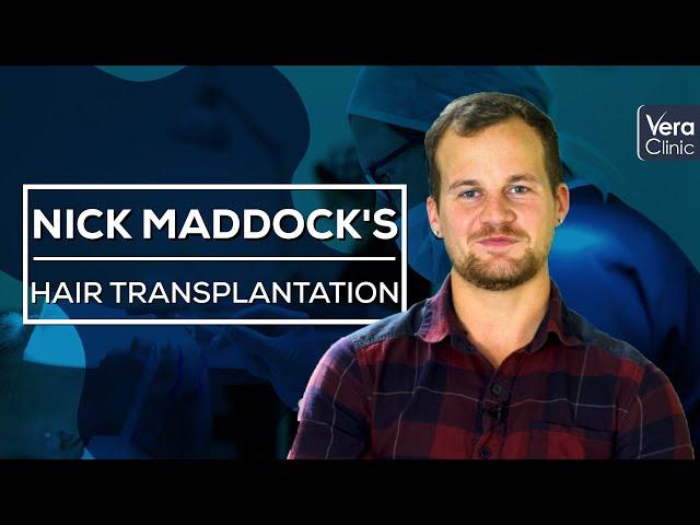 Nick Maddock’s Hair Transplantation Experience in Vera Clinic, Istanbul – Turkey