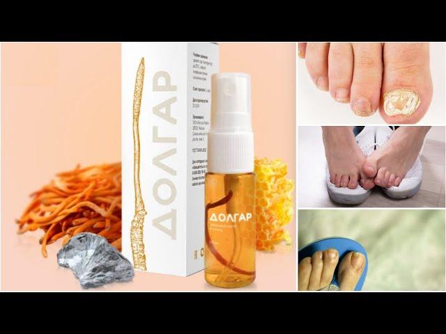 Мазь Долгар от грибка ногтей: купить здесь!