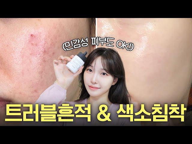 cc) The king of home care! The real way to easily remove acne marks and pigmentation..ㅣArang