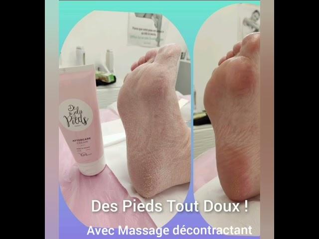 TRAITEMENTS ANTI -CALLOSITES YUMI-FEET PRODUITS FRANCAIS