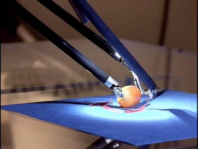 da Vinci Hysterectomy