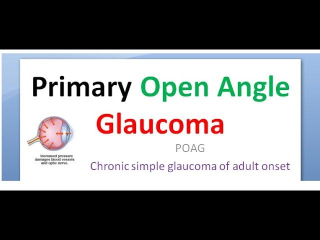 Ophthalmology 236 a Primary Open Angle Glaucoma POAG Symptom Classification risk factor Diurnal test