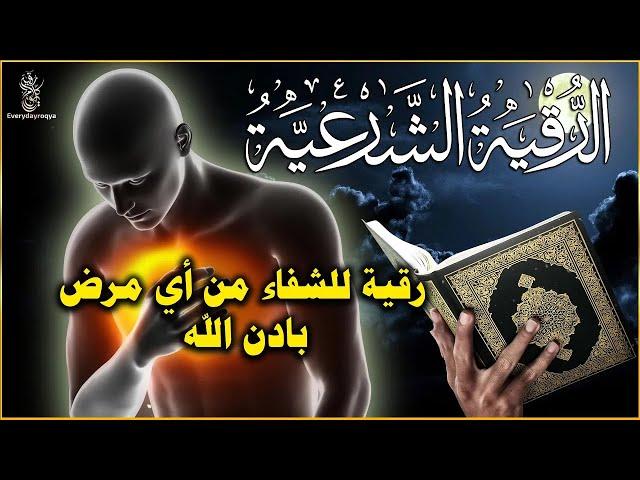 الرقية الشرعية الشاملة الرقية تدمر الجن الذي يسكن الأنف والرأس | بواسطة حسام المعصبي