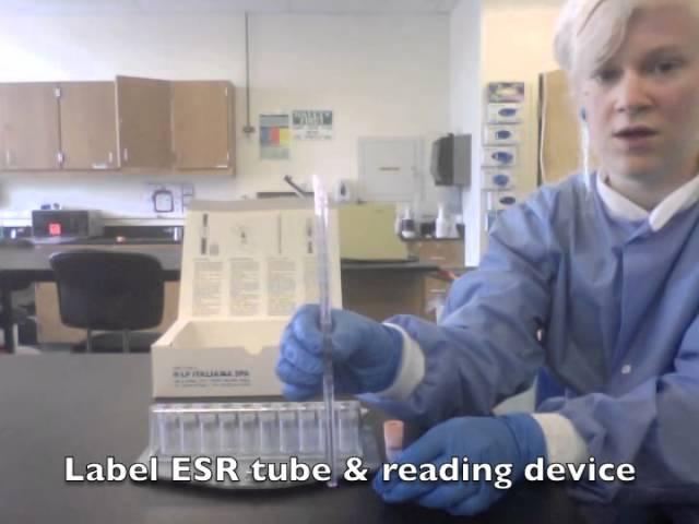 MLS Erythrocyte Sedimentation Rate