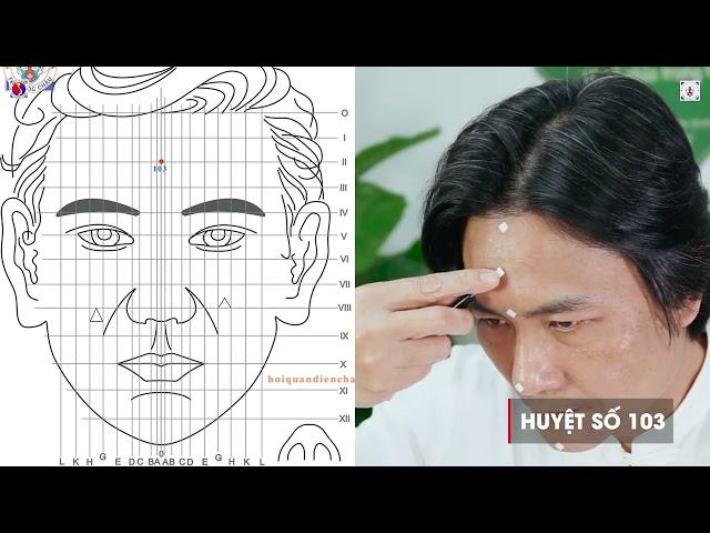 Xác Định Huyệt Mốc trong Diện Chẩn Bùi Quốc Châu | G.V Huỳnh Tâm Bình hướng dẫn