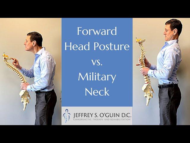 Forward Head Posture vs  Military Neck