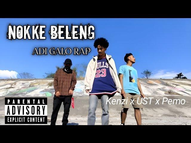 Kenzi x UST x Pemo Riba - Nokke Beleng (Music Video)