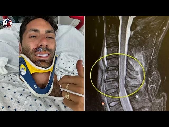 Nev Schulman Reveals He Broke His Neck in Accident Involving His Bike and a Truck: I’m Not Paralyzed