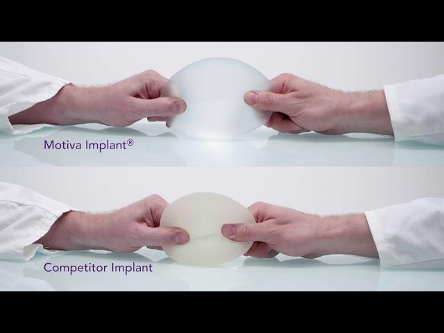 Motiva Implants - Elasticity