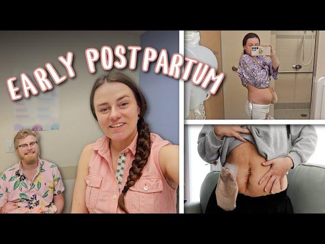 The First Few Weeks Postpartum | Belly Update and Learning Boundaries | Let's Talk IBD