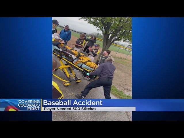 Loveland Boy Receives 500 Stitches After Colliding With Fence