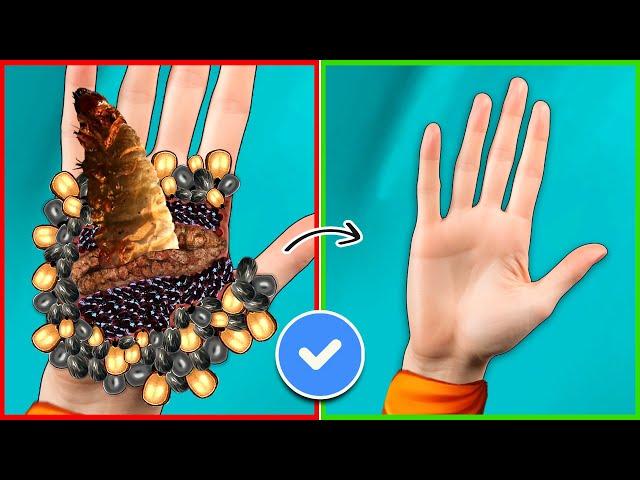 ASMR Remove Dog Ticks & Maggots From Hand | Severely Injured Treatment Animation