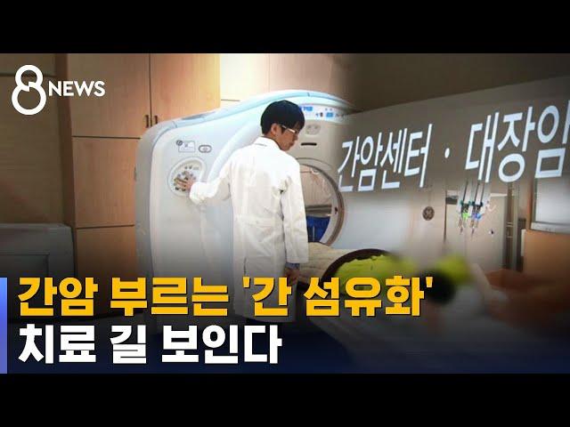 간암 부르는 '간 섬유화'…국내 연구팀이 치료 길 열었다 [건강라이프] / SBS 8뉴스