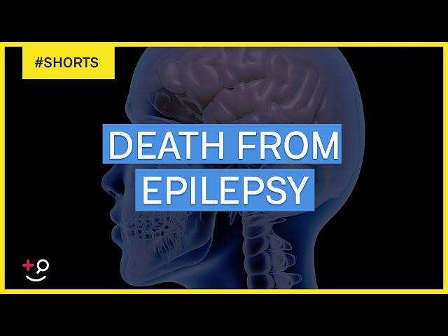 Can You Die From Epilepsy?  #Shorts