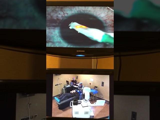 Laser eye surgery - YIKES