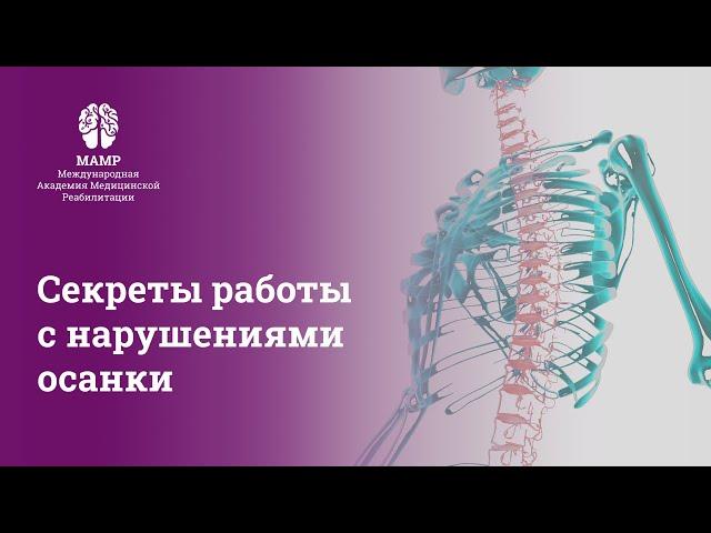 Прямой эфир: Формирование осанки: реабилитация и мифы. Вебинар для врачей от МАМР | МАМР