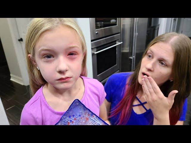 Trinity Has an Allergic Reaction!!! Her Eye is Swollen!