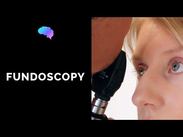 Fundoscopy (Ophthalmoscopy) - OSCE Guide | UKMLA | CPSA | PLAB 2