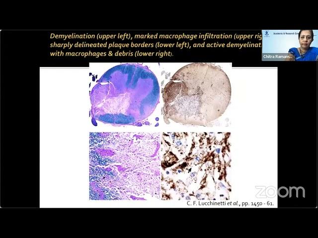 AIOS ARC Diagnosing the... DR. ANDREW G LEE