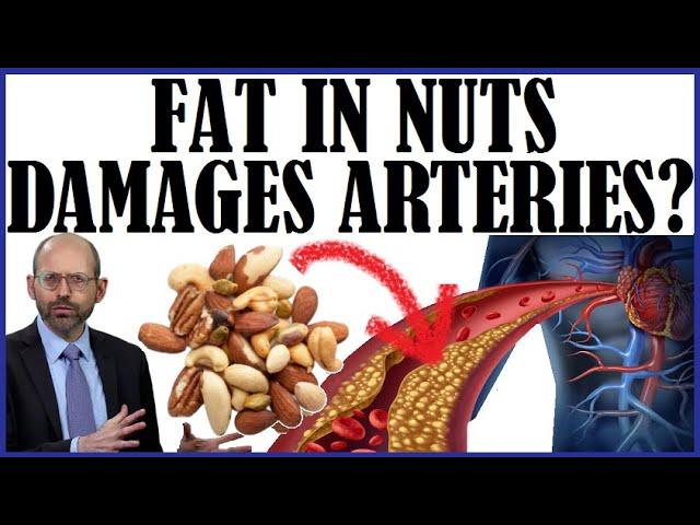 Does The Fat In Nuts Damage Our Arteries?