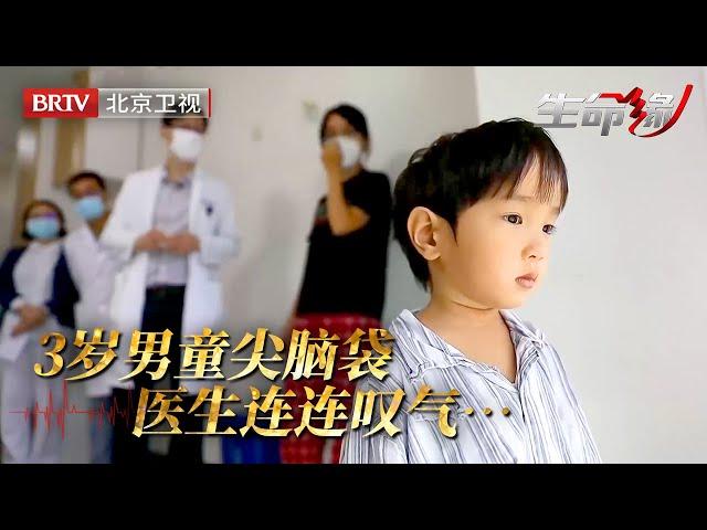 3岁男孩从出生脑袋就是尖的，医生感叹无力回天，治疗太晚恐一辈子大脑残缺，要想根治只能打碎所有骨头……【生命缘第12季】