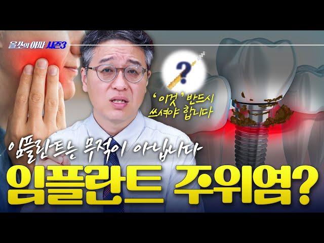 임플란트 관리 안 하면 생기는 충격적 결과 – [올쏘의 아싸 시즌3] EP40