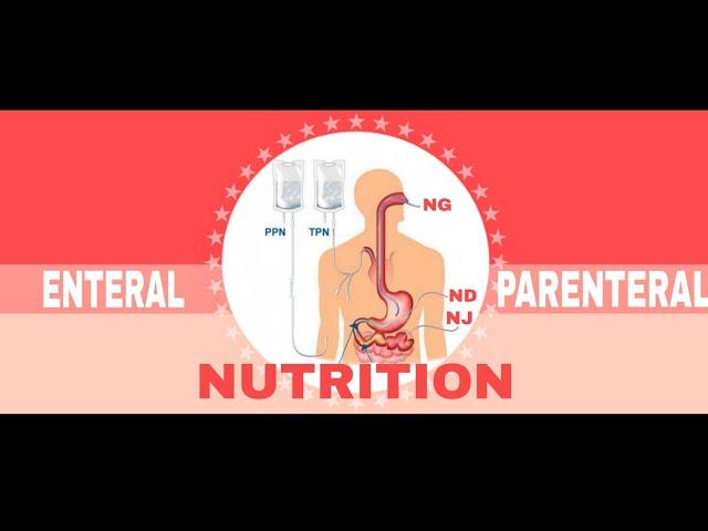 NUTRITIONAL SUPPORT | ENTERAL & PARENTERAL NUTRITION (2/2)