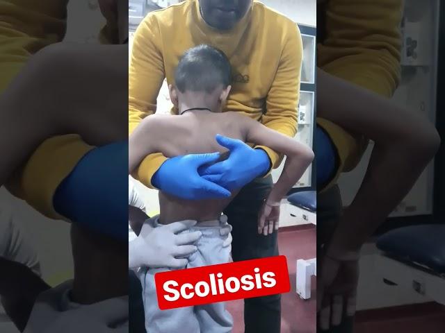 scoliosis treatment by Indian chiropractor Dr.Rajneesh kant 9308511357,8409313131