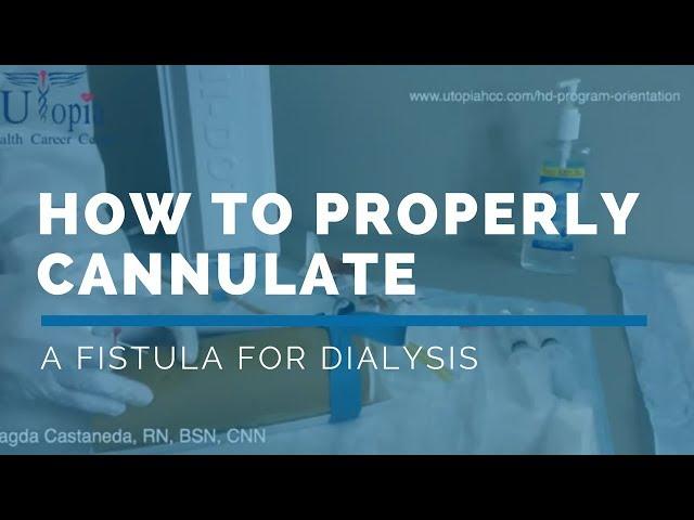 HOW TO PROPERLY CANNULATE A FISTULA in 2022