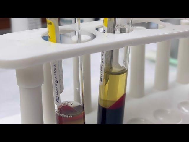 Pulling Plasma for a PRP #plasma #plateletrichplasma #prp #satisfying