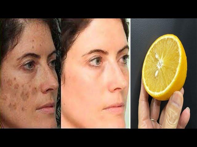 100 year-old Recipe - Remove Sagging Skin, Fade Dark Spots and Glowing Skin!