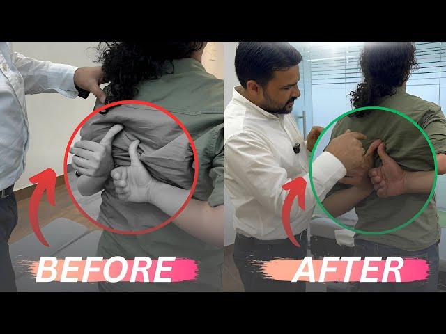 Shoulder blade pain treatment by dr harish grover