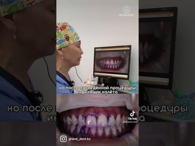 Лайфхак от стоматолога 2