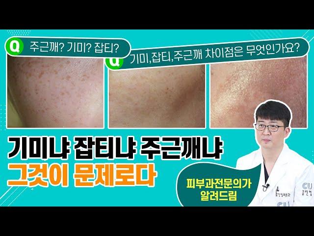 기미, 주근깨, 잡티 구별 가능? 정확히 알고 제대로 관리하자! 피부과전문의가 알려드림