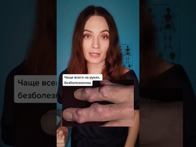 Образования на пальцах