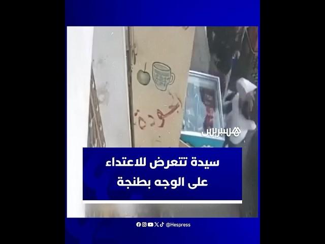 مضطرب عقليا يعتدي على سيدة بأداة حادة على مستوى الوجه بمنطقة أشناد بطنجة