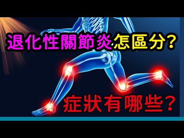 退化性關節炎怎區分？症狀有哪些？