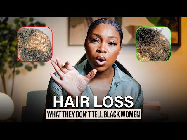 The Truth About Hair Loss in Black Women - What You Need to Know Today