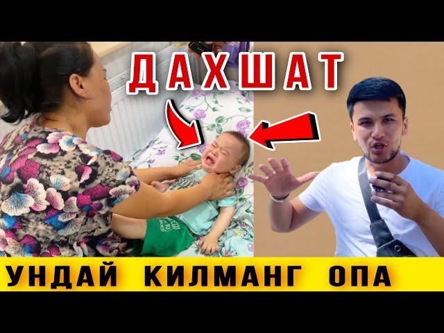  Опа Ундай Килманг. Клиникада Булган Холат. Тезкор